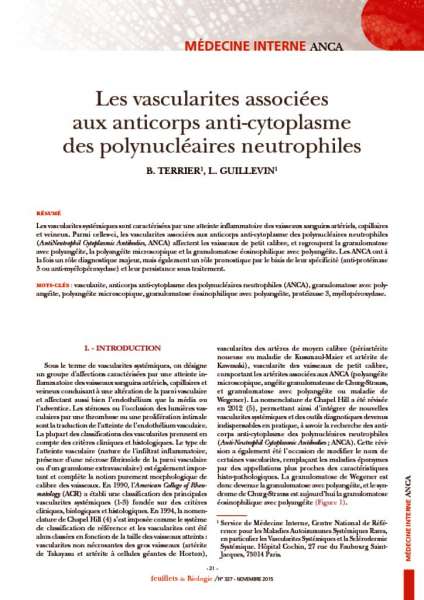 thumbnail of Les vascularites associées aux ANCA